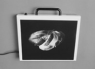 mir liegt ein Stein im Magen