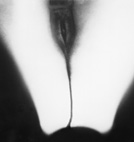 Reife Bluete, 60x60, 380 Euro